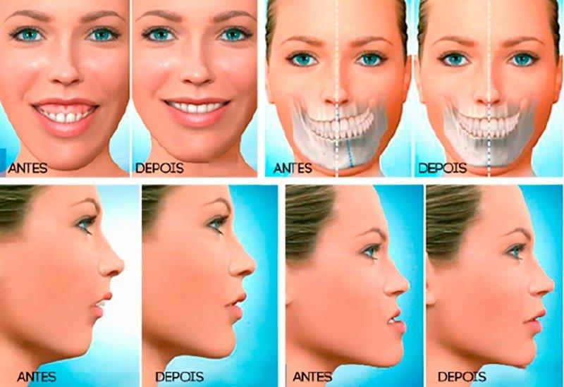 buco-maxilo-facial